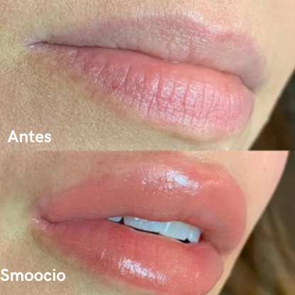 Repulpador de labios extremo - SMOOCIO